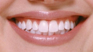 Zubní sklovina