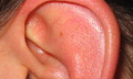 Co na bolest uší